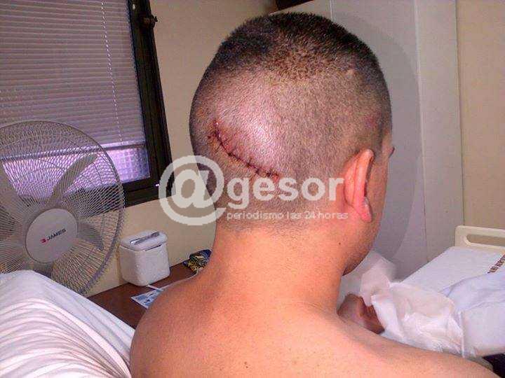 Tras la agresión que sufrieron cuatro funcionarios policiales en la búsqueda de recapturar al reclusos Sebastián Lares Pereira fugado desde el 9 de noviembre, sus camaradas reclaman mayor rigor a la Justicia y apoyo a la comunidad